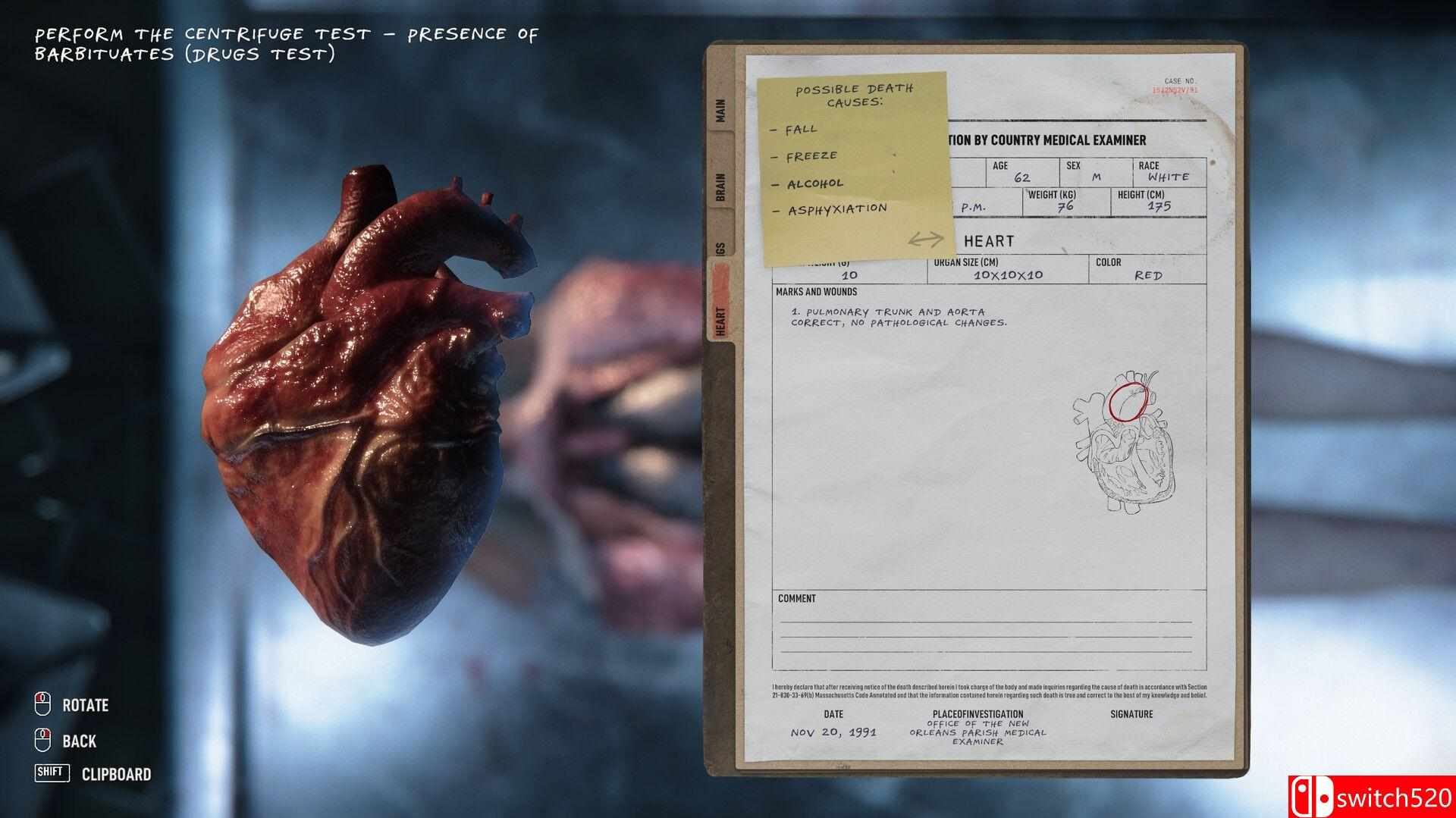 《验尸模拟器（Autopsy Simulator）》官方中文 FLT镜像版[CN/TW/EN/JP]_3
